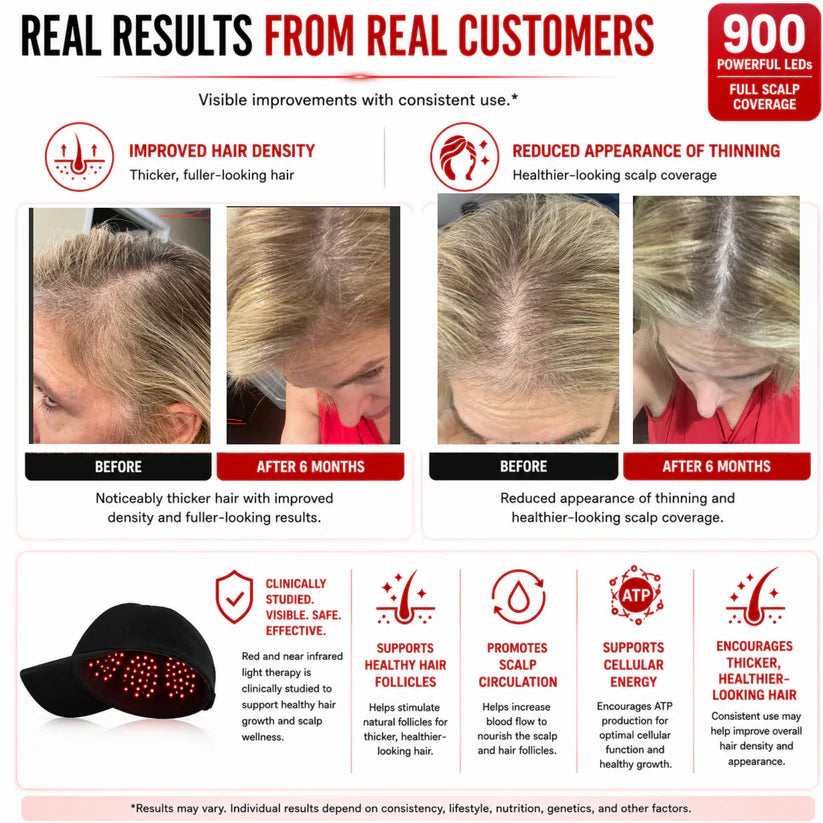 Red Light Therapy Hat – 900 LEDs for Hair Regrowth & Recovery